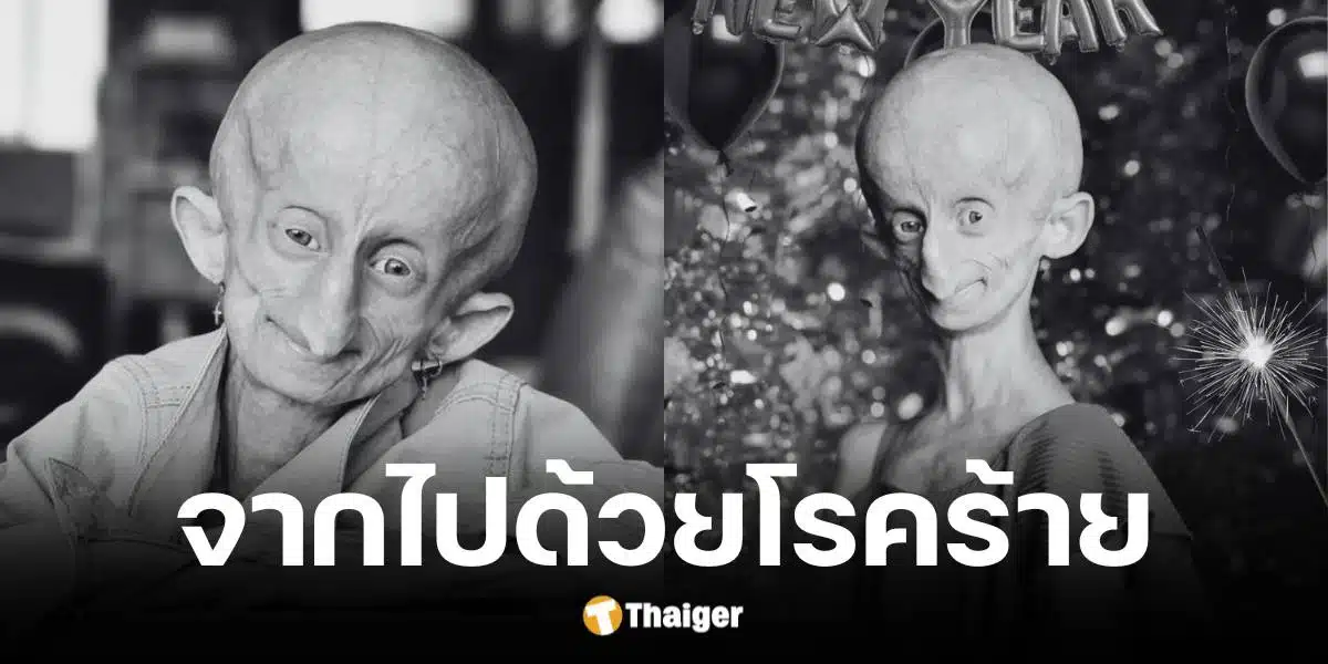 บรีนดริ บูเซ่น เสียชีวิตในวัย 19 ปี ด้วยโรคแก่ก่อนวัย