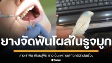 สาวทำฟัน เกือบสู่ขิต หลังเจอยางจัดฟันติดในโพรงจมูก ชาวเน็ตแฉ คลินิกหลายแห่งให้ผู้ช่วยทำแทนทันต์แพทย์