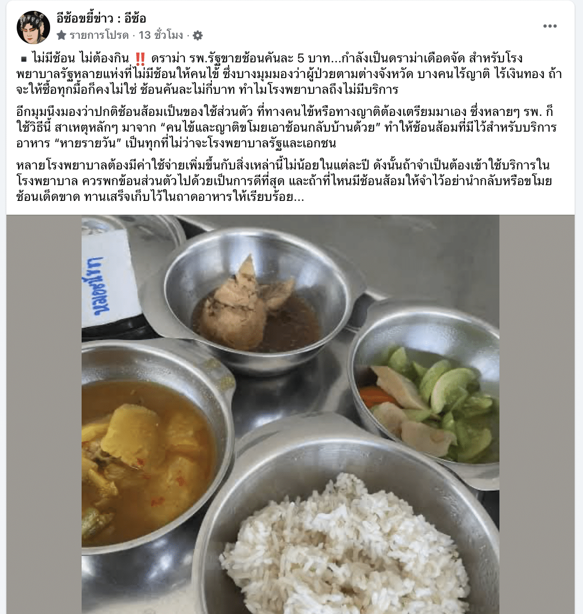 เพจอีซ้อเผยสาเหตุ ต้องเก็บเงินค่าช้อนคนไข้