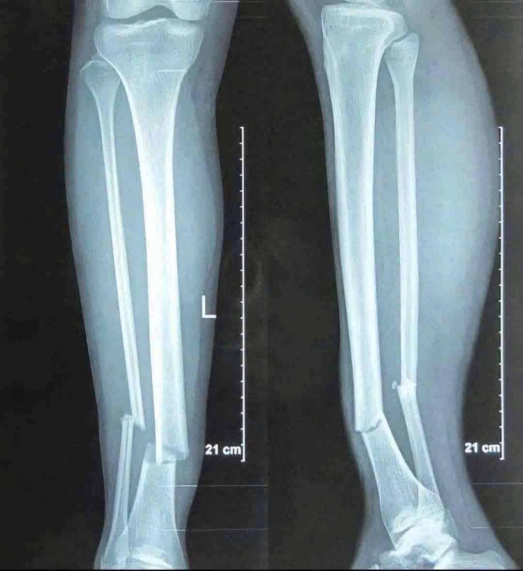 เหงียน ซวน ซอน