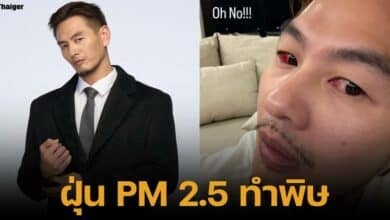 บีม ศรัณยู อัปเดตอาการตาอักเสบ จากฝุ่น PM 2.5