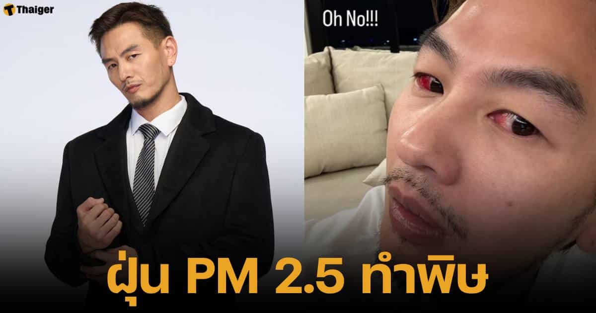 บีม ศรัณยู อัปเดตอาการตาอักเสบ จากฝุ่น PM 2.5