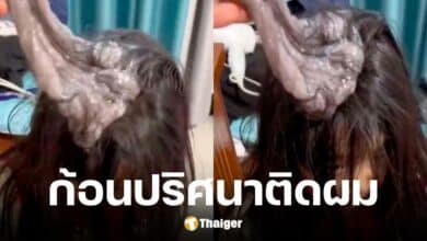ลูกสาวกลับจากโรงเรียนมีสไลม์ติดผม สุดท้ายต้องให้แพทย์ช่วย