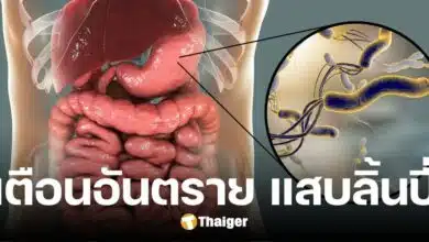 อย่าชะล่าใจ ปวดท้องตรงลิ้นปี่ หากปล่อยทิ้งไว้นาน อาจกลายเป็นมะเร็ง
