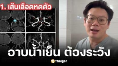 หมอเจดอธิบายอาบน้ำเย็นช่วงหน้าหนาวเพิ่มโอกาสการเป็นโรคเส้นเลือดในสมองตีบ-แตก