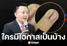 หมอหมู วีระศักดิ์ ตอบแล้ว รอยขีดบนเล็บสีน้ำตาล คือสาเหตุของโรคมะเร็งใช่ไหม