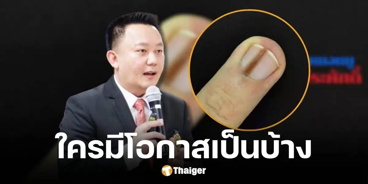 หมอหมู วีระศักดิ์ ตอบแล้ว รอยขีดบนเล็บสีน้ำตาล คือสาเหตุของโรคมะเร็งใช่ไหม