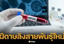 พบผู้ติดเชื้อไวรัสฝีดาษลิง สายพันธุ์ใหม่ ในฝรั่งเศส เจ้าหน้าที่เร่งสอบสวน