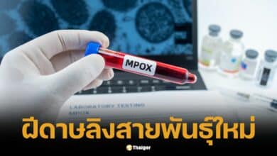 พบผู้ติดเชื้อไวรัสฝีดาษลิง สายพันธุ์ใหม่ ในฝรั่งเศส เจ้าหน้าที่เร่งสอบสวน