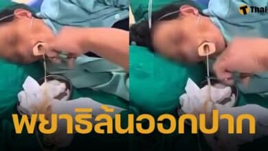 คลิปสยอง หมอใช้ที่คีบดึง พยาธิตัวตืด ยาวหลายเมตร ออกจากปากคนไข้ พบชอบกินอาหารดิบ ลาบก้อย ซกเล็ก ซอยจุ๊