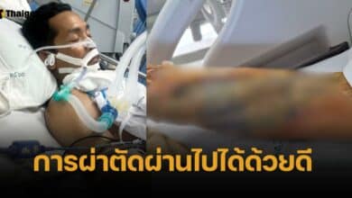 ปลอดภัยแล้ว บังฉา อ่าวนาง มือปราบอสรพิษ หลังโดนจงอางกัดกลางแขน