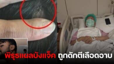 บังแจ็ค ล่าสุด