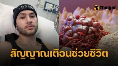 สัญญาณเตือนมะเร็ง มักมองข้าม หนุ่ม 21 ป่วยมะเร็งต่อมน้ำเหลือง บอกเอง