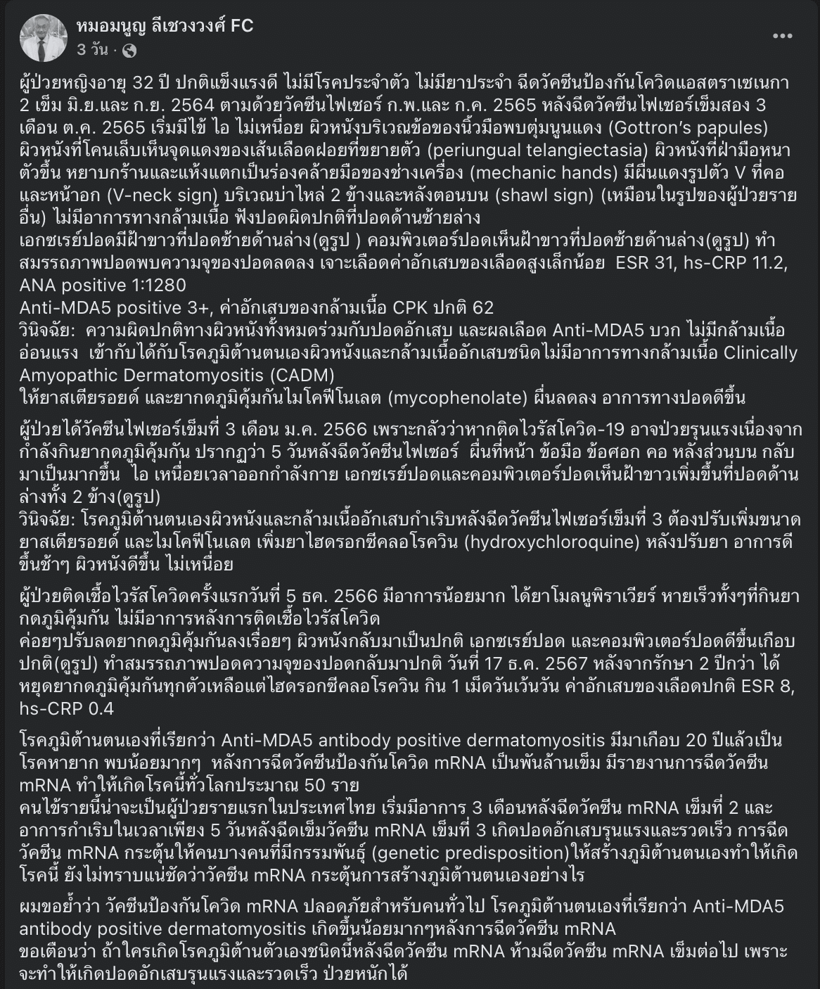 รายแรกในไทย หมอมนูญ เผยเคส ฉีดวัคซีนโควิด mRNA ป่วยโรคภูมิต้านตนเองรุนแรง