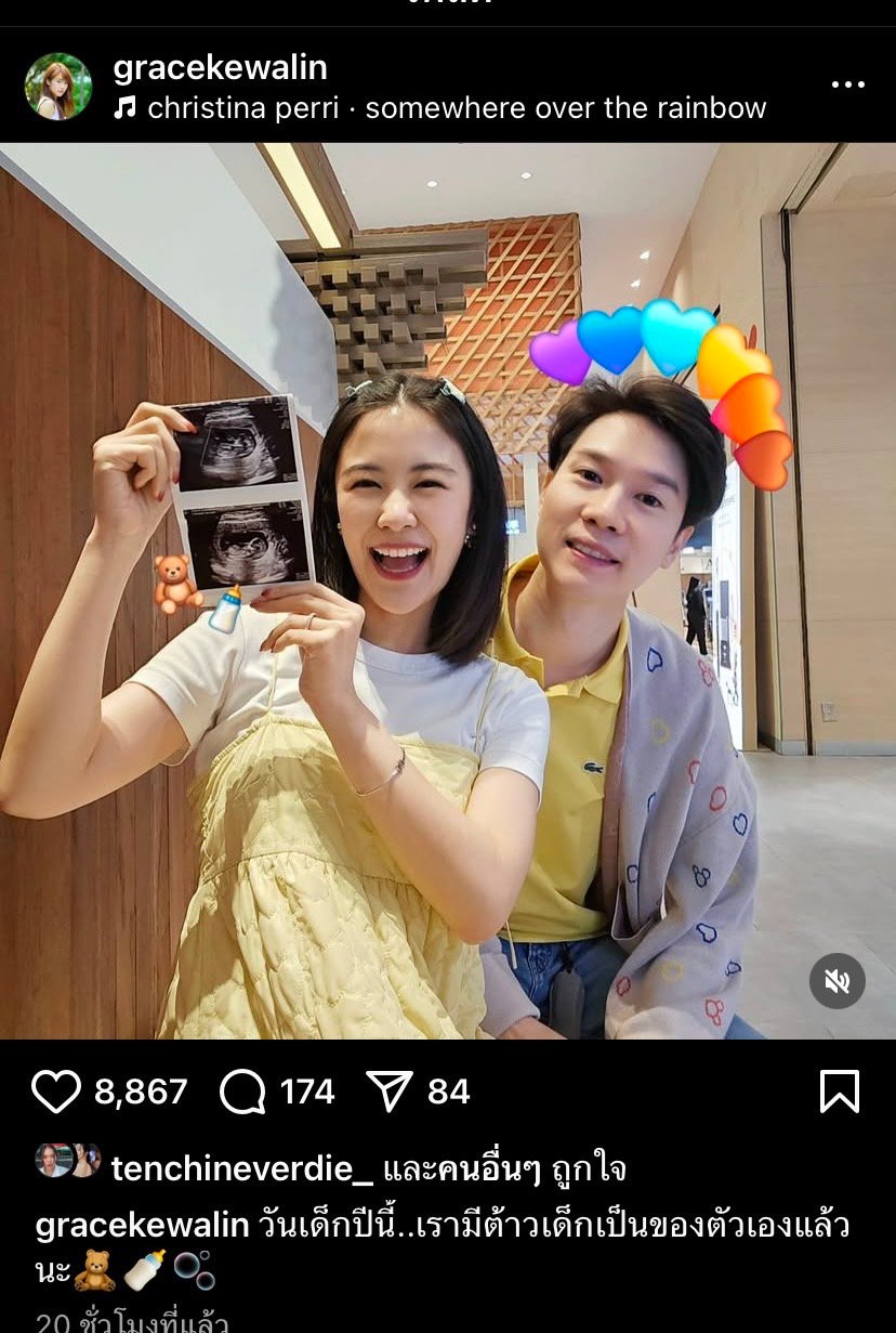 หมอเก่ง วาโย - เกรซ เกวลิน อวดภาพอัลตร้าซาวด์ ลูกคนแรก หลังแต่งงานครบ 4 ปี