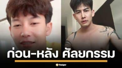 เทียบชัด! "ครูเต้ย อภิวัฒน์" ก่อน-หลัง ศัลยกรรมจมูก ออร่าลูกทุ่งอินดี้พุ่งแรง เผยเคล็ดลับ "ฟิตหุ่น" เสริมหล่อ แฟนคลับแห่กรี๊ด! #ครูเต้ยอภิวัฒน์ #ศัลยกรรม #ลูกทุ่งอินดี้