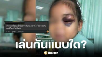 แม่ร้อง ลูกเล่นกับเพื่อนแล้วตาบวม โดนพ่อคู่กรณีโพสต์ท้าทาย