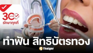 เปิดสิทธิทำฟัน บัตรทอง 30 บาทรักษาทุกที่ รักษาฟรี 5 รายการ ประกันสังคม ให้ไม่ได้