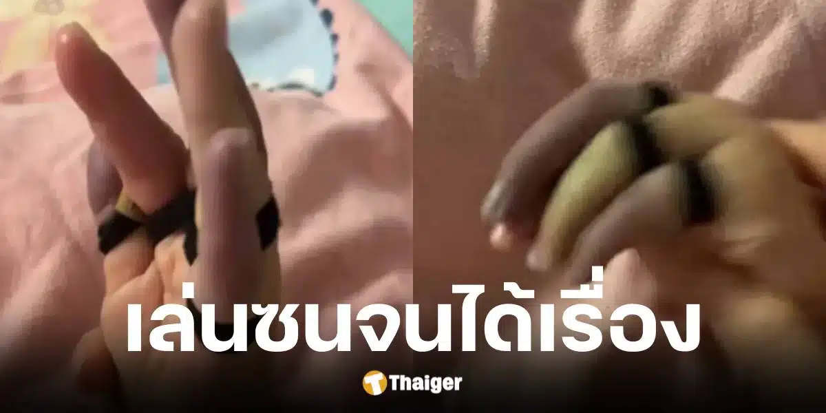 ลูกชายร้องไห้หลังถูกยางรัดนิ้วมือจนแน่น แม่รีบช่วยหวั่นเกิดอันตราย