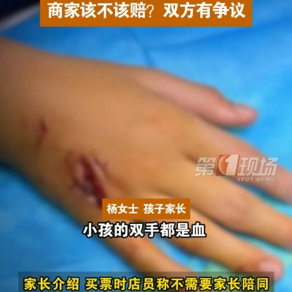 เด็ก 9 ขวบ เหยื่อจระเข้งับ