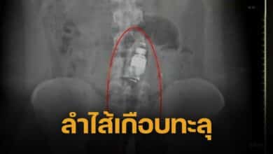 แฟนยัดแท่งยักษ์ 20 ซม. ทะลวงทวารหนัก เสร็จชิ่งหนี ทิ้งให้สั่นค้างคืน