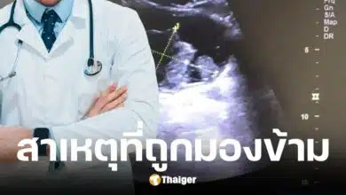 หนุ่ม 33 ปี ฉี่เป็นเลือดนาน 1 ปี เพราะสูบบุหรี่จัดตั้งแต่อายุ 15 ปี