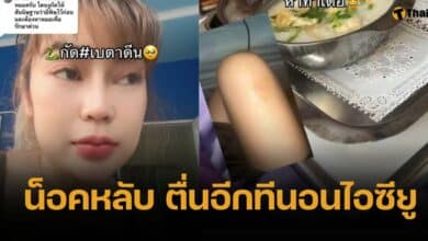 สาวถูกงูเห่ากัด ทาเบตาดีนสู้พิษ ก่อนเข้าเวรต่อ สุดท้ายภาพตัด ตื่นอีกทีอยู่ไอซียู