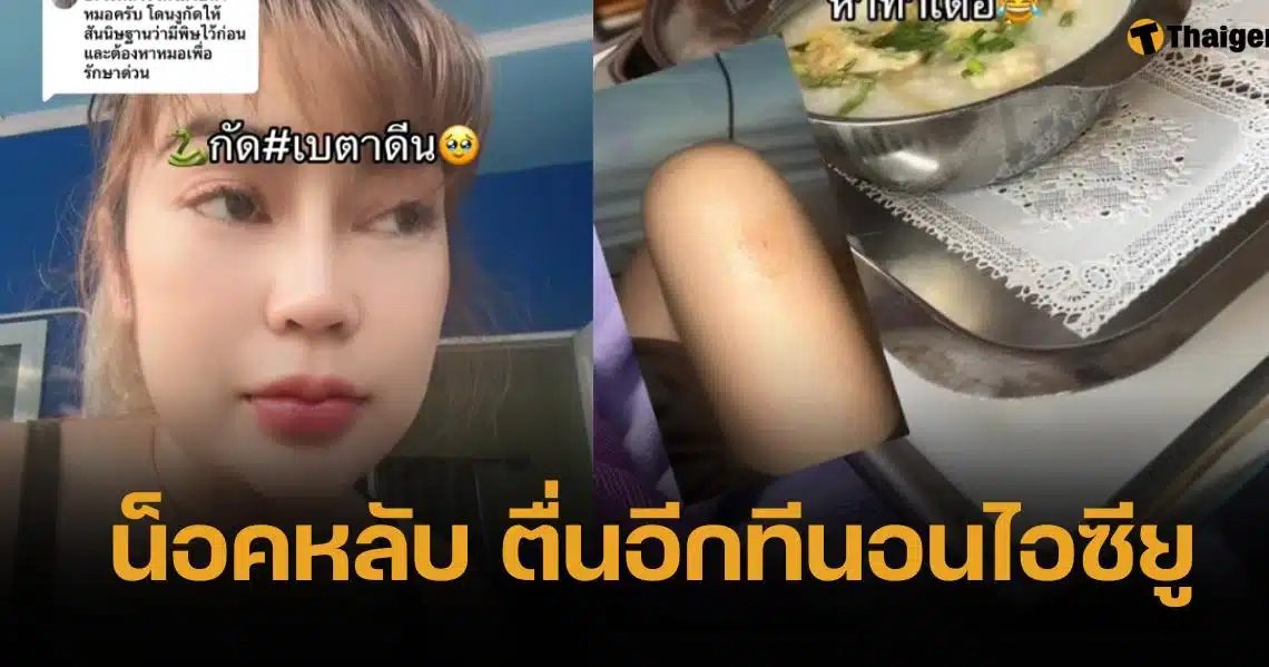 สาวถูกงูเห่ากัด ทาเบตาดีนสู้พิษ ก่อนเข้าเวรต่อ สุดท้ายภาพตัด ตื่นอีกทีอยู่ไอซียู