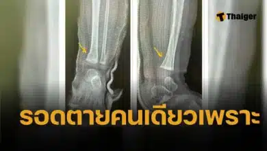 เด็ก 9 เดือนรอดชีวิตรถชน สูญเสียทั้งพ่อ แม่ และยาย หมอเผย “หลวงพ่อ car seat” คือฮีโร่ตัวจริง