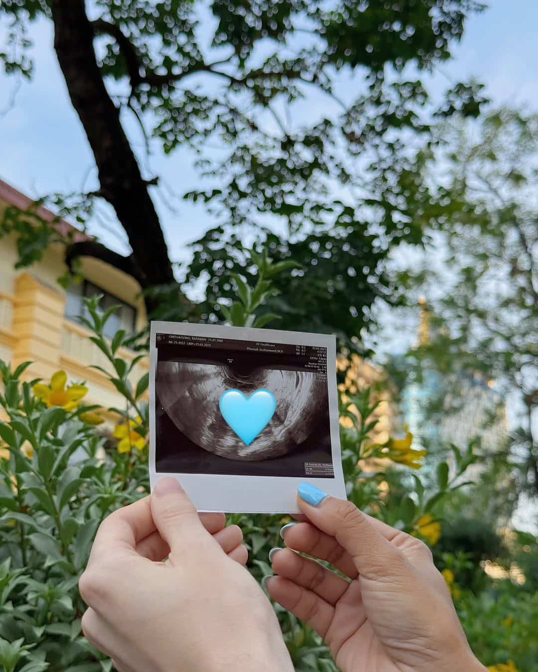 มิน รตวรรณ หรือ ละม่อม ไข่ตุ้ม ประกาศ ท้อง กับแฟนหนุ่มต่างชาติ-3