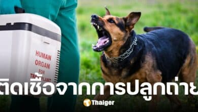 ผู้ป่วยสหรัฐฯ เสียชีวิตสยอง ติดพิษสุนัขบ้า จากอวัยวะปลูกถ่าย เคสหายากในโลก