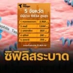 เปิด 5 จังหวัด 'ซิฟิลิส' ระบาดหนัก เช็กอาการระยะแรก ปล่อยไว้นานทรมานมาก