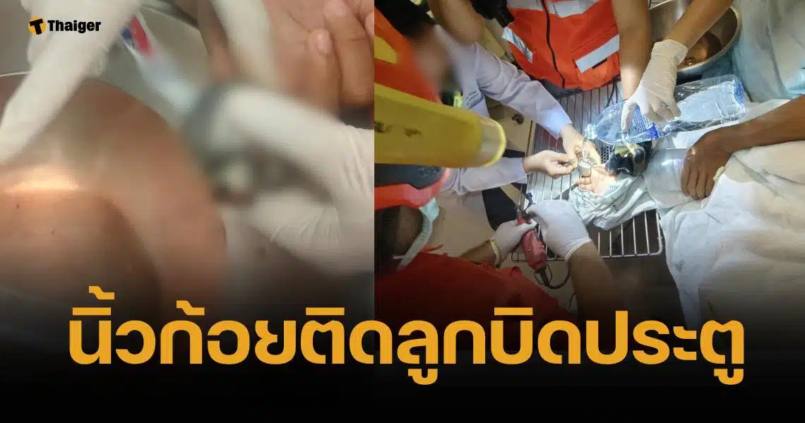 เด็ก 16 เอานิ้วก้อยแหย่ลูกบิด แต่ดึงไม่ออกจนนิ้วเริ่มบวม กู้ภัยเร่งช่วยเหลือ