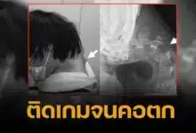 อุทาหรณ์ หนุ่มก้มหน้าติดจอหนัก จนกระดูกคอห้อย เงยหน้าไม่ขึ้น กลืนอาหารลำบาก