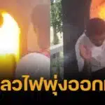 อ.แจ๊คพันศพ เปิดใจ หลังถูกไฟลวกใบหน้า ขณะวางดอกไม้จันทน์ในโลง