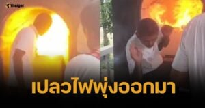อ.แจ๊คพันศพ เปิดใจ หลังถูกไฟลวกใบหน้า ขณะวางดอกไม้จันทน์ในโลง