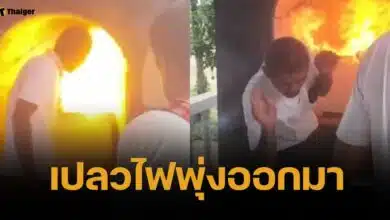 อ.แจ๊คพันศพ เปิดใจ หลังถูกไฟลวกใบหน้า ขณะวางดอกไม้จันทน์ในโลง