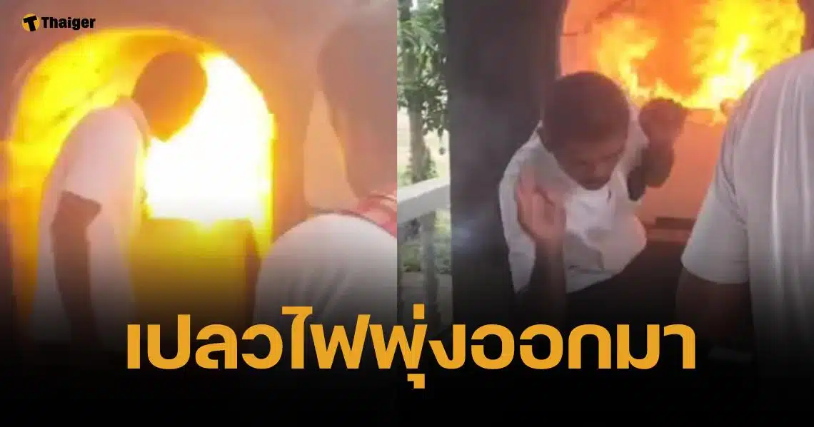 อ.แจ๊คพันศพ เปิดใจ หลังถูกไฟลวกใบหน้า ขณะวางดอกไม้จันทน์ในโลง
