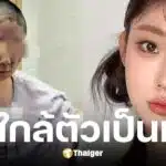 ถงเหยา อินฟลูฯ สาว บ้านระเบิดหน้าเสียโฉม คาดพ่อจุดบุหรี่ขณะแก๊สรั่ว