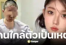 ถงเหยา อินฟลูฯ สาว บ้านระเบิดหน้าเสียโฉม คาดพ่อจุดบุหรี่ขณะแก๊สรั่ว