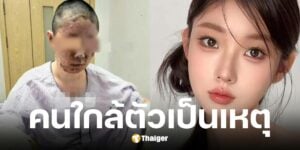 ถงเหยา อินฟลูฯ สาว บ้านระเบิดหน้าเสียโฉม คาดพ่อจุดบุหรี่ขณะแก๊สรั่ว