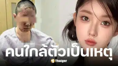 ถงเหยา อินฟลูฯ สาว บ้านระเบิดหน้าเสียโฉม คาดพ่อจุดบุหรี่ขณะแก๊สรั่ว