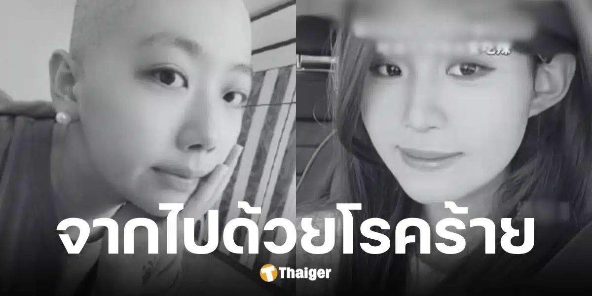 เฉียนเฉียน เน็ตไอดอลสาววัย 25 ดับแล้วด้วยมะเร็งกระเพาะ