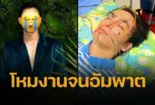 พระเอกดัง หน้าเบี้ยว เป็นอัมพาต เกือบหมดหล่อ เตือน 3 นิสัยวัยรุ่นชอบ ทำลายสุขภาพ
