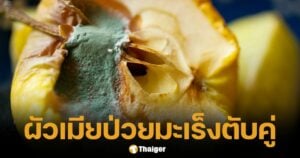 นิสัยเสียดายของ คร่าชีวิต ผัวเมียป่วยมะเร็งตับคู่ เหตุกินผลไม้เน่า-ถั่วเก่า