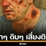 เพจดัง โพสต์คลิปสัตว์ล้มตายจากประเทศเพื่อนบ้าน วอนจับตา "โรคแอนแทรกซ์" ระบาดประชิดชายแดนไทย รู้จัก 3 ช่องทางติดสู่คน-วิธีป้องกัน ก่อนสาย