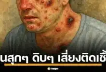 เพจดัง โพสต์คลิปสัตว์ล้มตายจากประเทศเพื่อนบ้าน วอนจับตา "โรคแอนแทรกซ์" ระบาดประชิดชายแดนไทย รู้จัก 3 ช่องทางติดสู่คน-วิธีป้องกัน ก่อนสาย