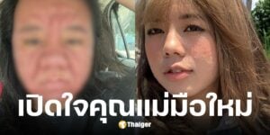 คุณแม่มือใหม่ ไม่แพ้ท้องแต่หน้าพังสิวเห่อ-จมูกบวม ผ่านมาได้เพราะสามี