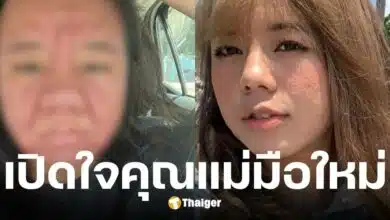 คุณแม่มือใหม่ ไม่แพ้ท้องแต่หน้าพังสิวเห่อ-จมูกบวม ผ่านมาได้เพราะสามี