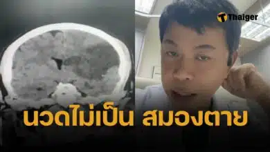 อย่าไว้ใจให้เมียนวด! หมอเตือน ชาย 54 ให้เมียนวดคอ ตื่นเช้ามา 'สมองตาย'